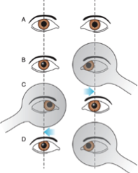 badanie wzroku z pomocą paletek